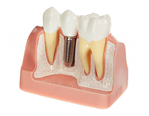 endodontie.png